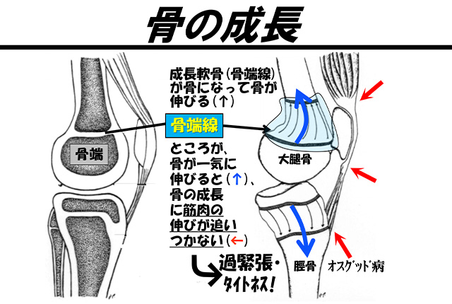 図2.膝関節を真横･側面からみている図